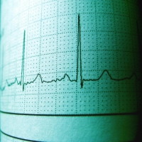 検診でPR短縮、発作性上室頻拍がAVNRTなのかAVRTなのか