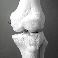 尺骨神経前方移行術後、肘を曲げ伸ばし、拳に力を入れると痛みが続く